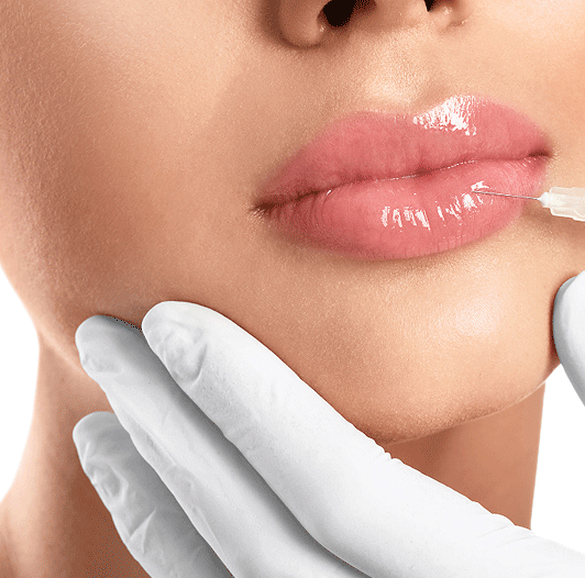 aesthetic treatments before and after 01