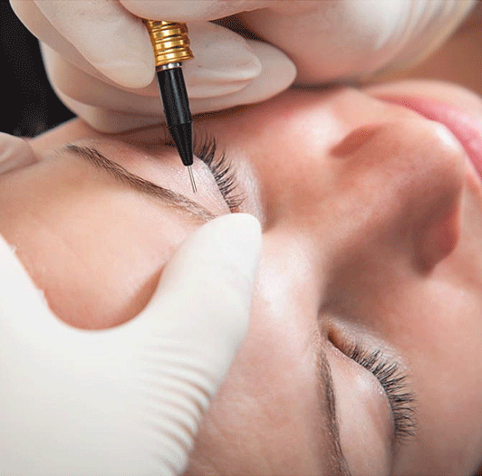 electrolysis before and after 01