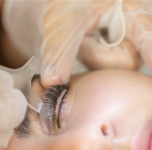 lvl before and after 03