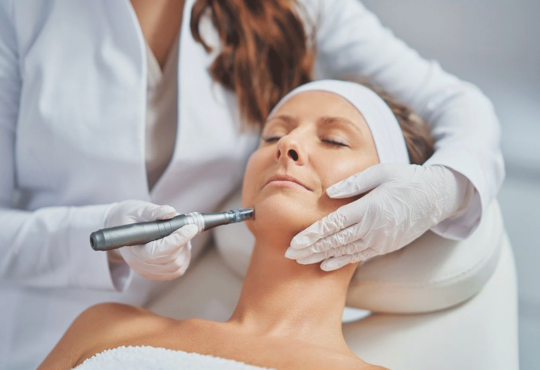 esr needling post image