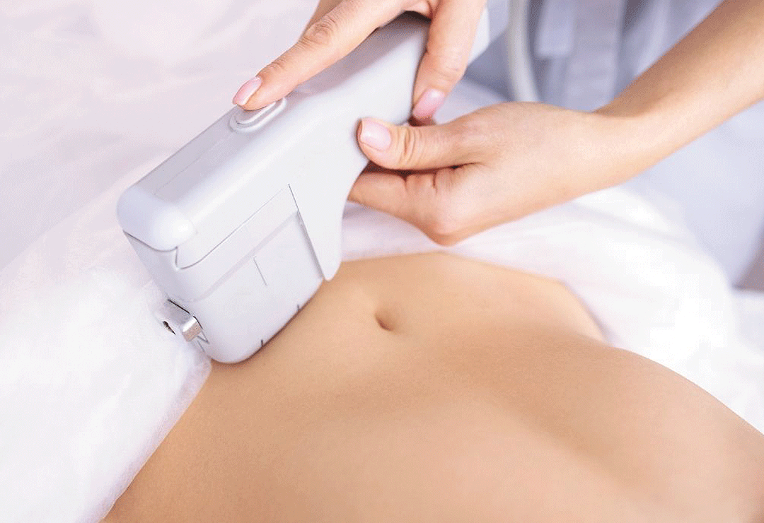 hifu body post image